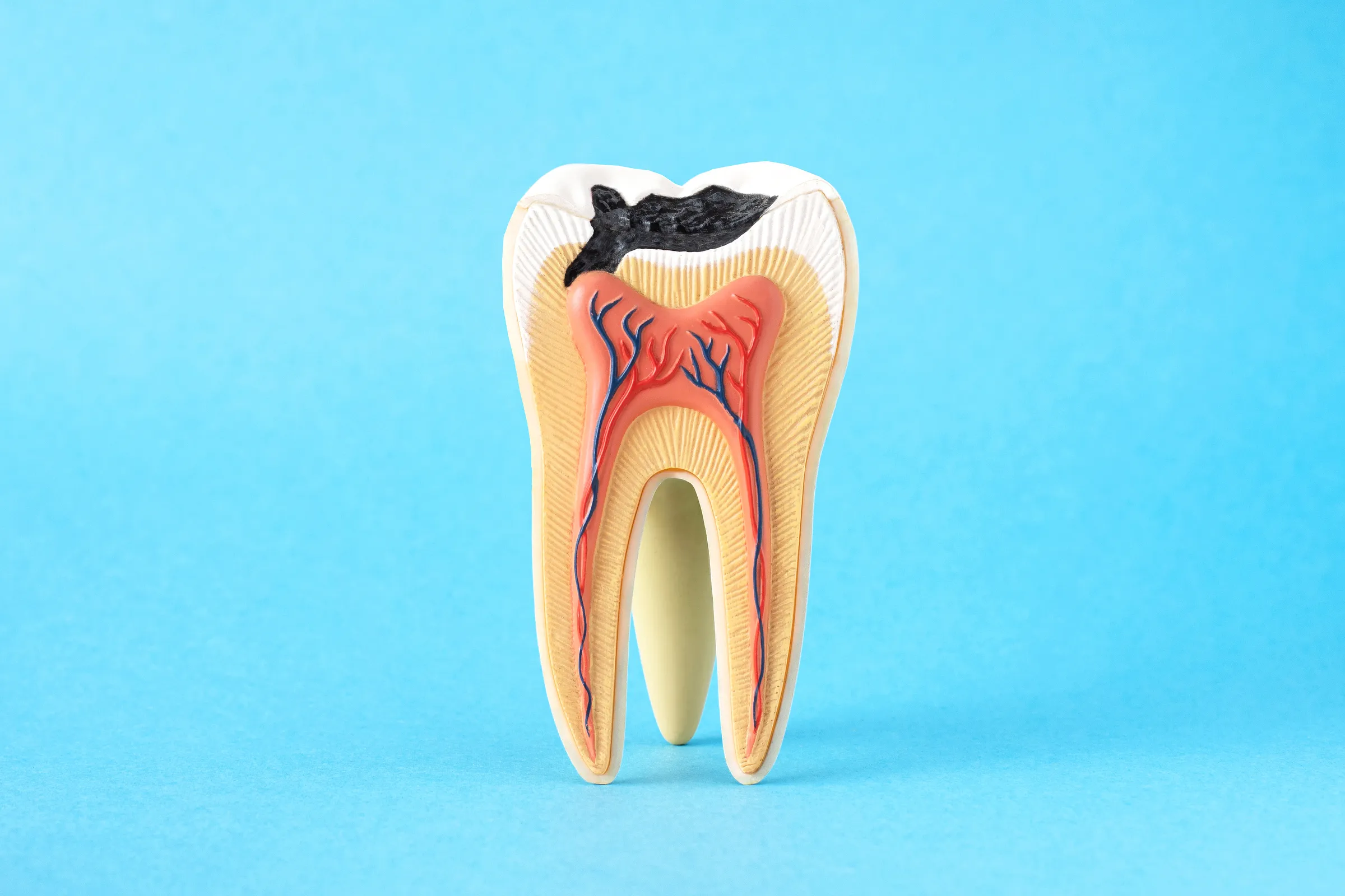 Comfortable root canal treatment at Dental Studio of Marin