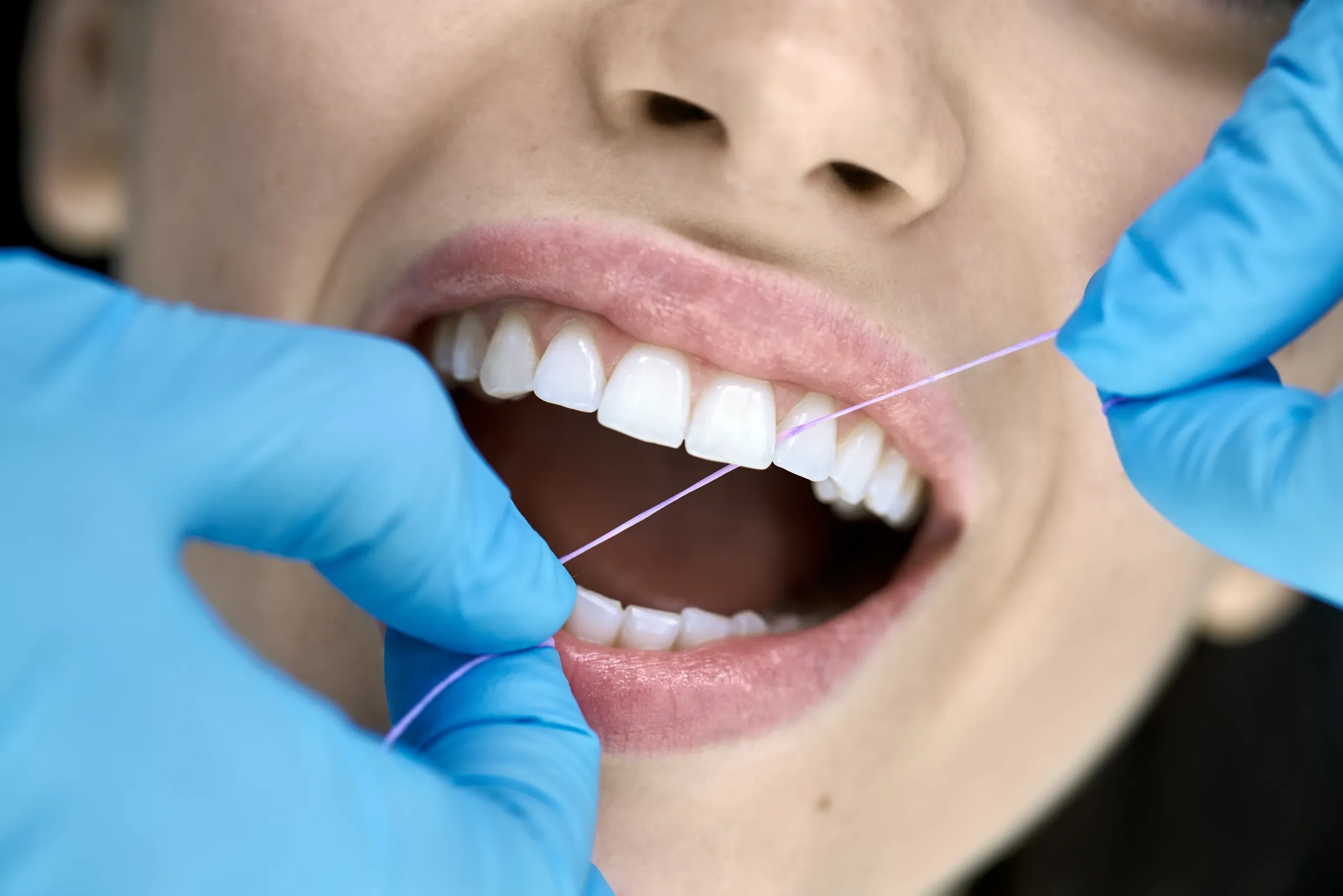 Dental hygienist performing a routine cleaning at Dental Studio of Marin