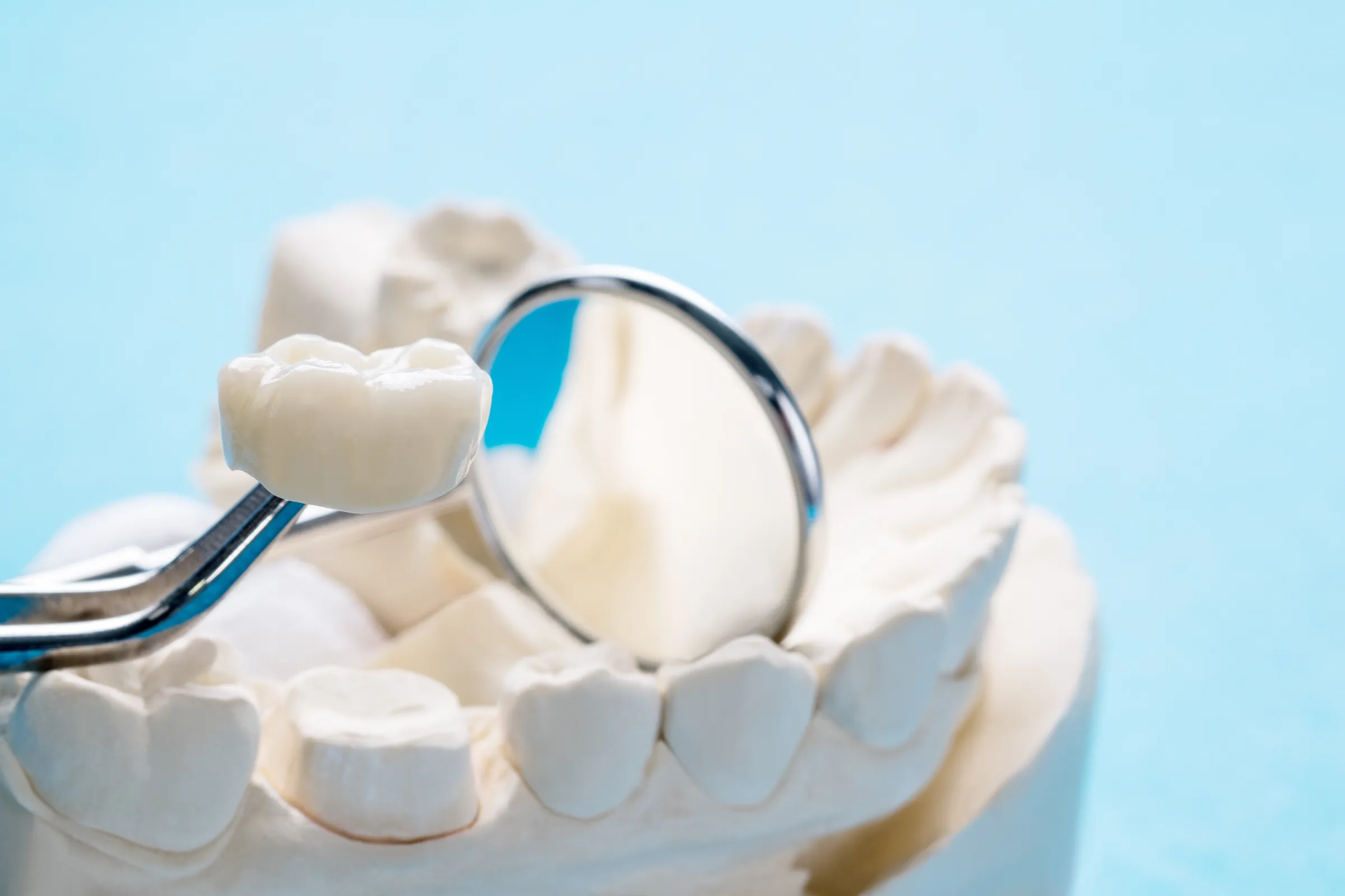 Dental crowns and bridges at Dental Studio of Marin
