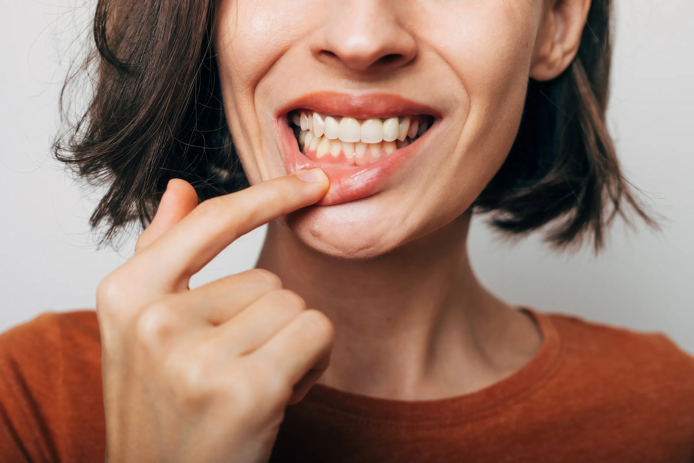 Crown lengthening procedure at Dental Studio of Marin