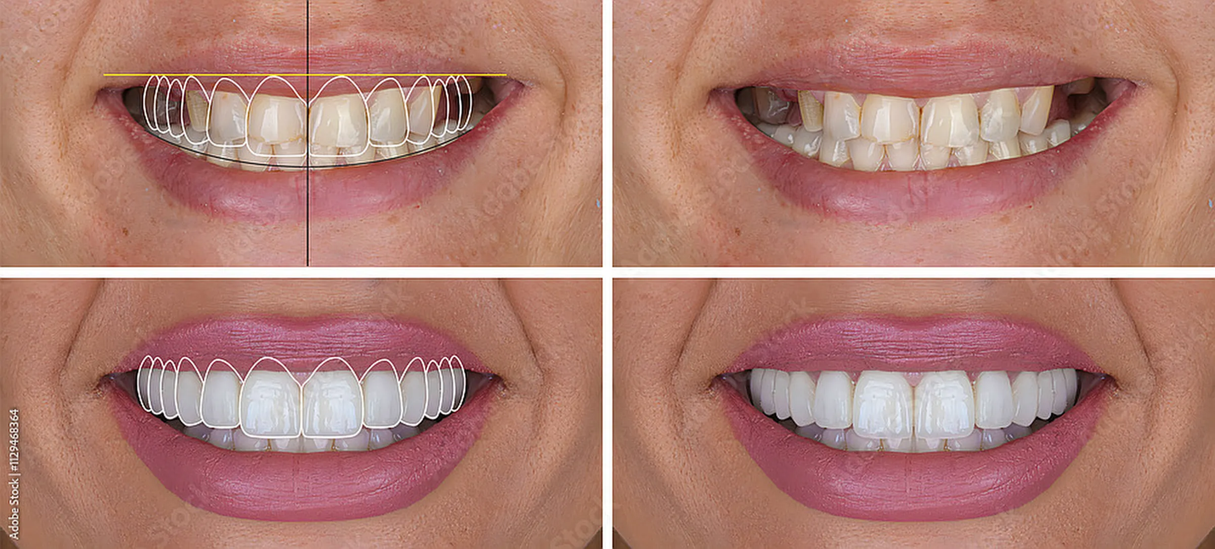 Smile makeover consultation at Dental Studio of Marin
