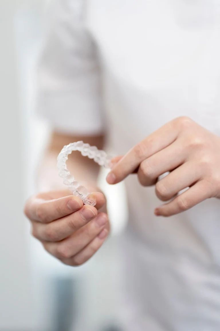 Clear Aligners