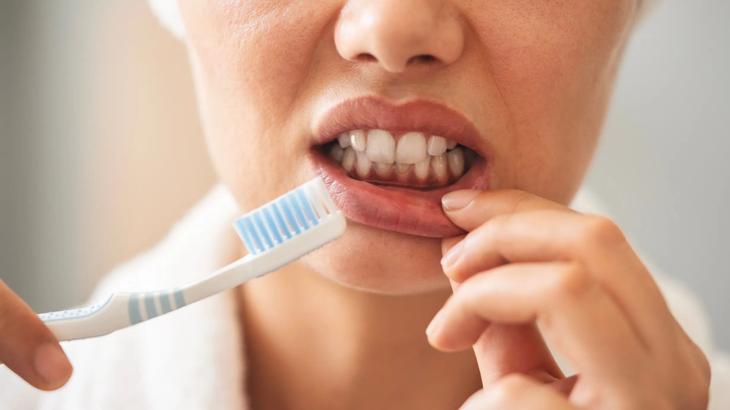 Gingivectomy procedure at Dental Studio of Marin